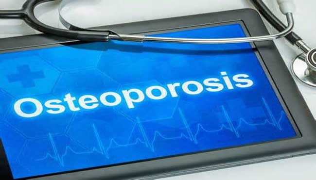 Meningkatkan Kesehatan Tulang