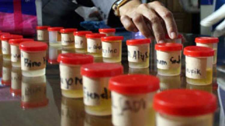 hasil tes urine pejabat kota tangerang